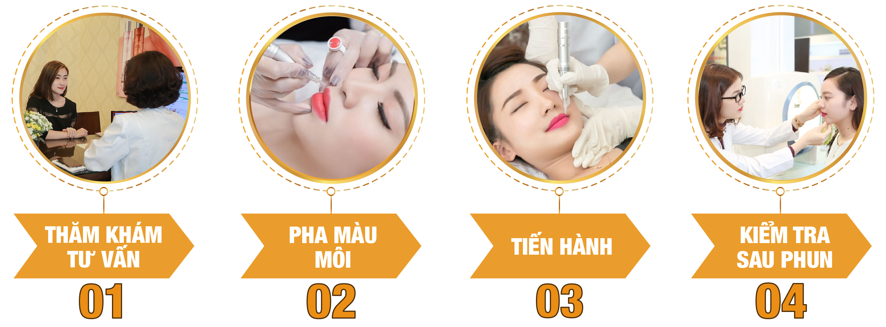 quy-trinh-phun-moi-collagen-phale