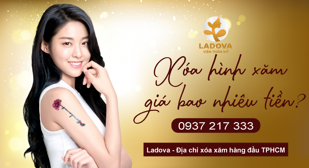 xoa-hinh-xam-gia-bao-nhieu-tien