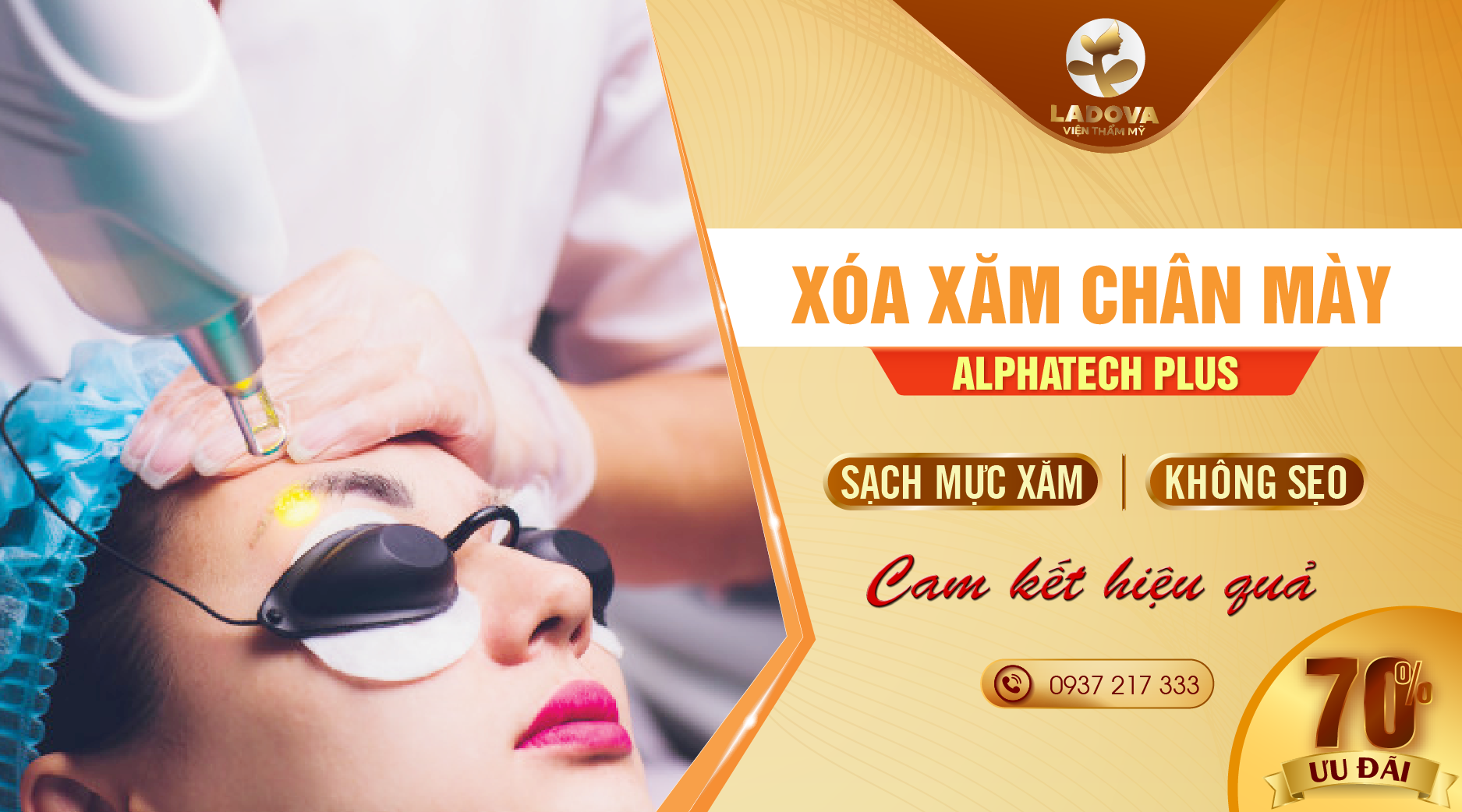 Xóa Xăm Chân Mày bằng Laser Alphatech Plus Sạch Mực Không Sẹo