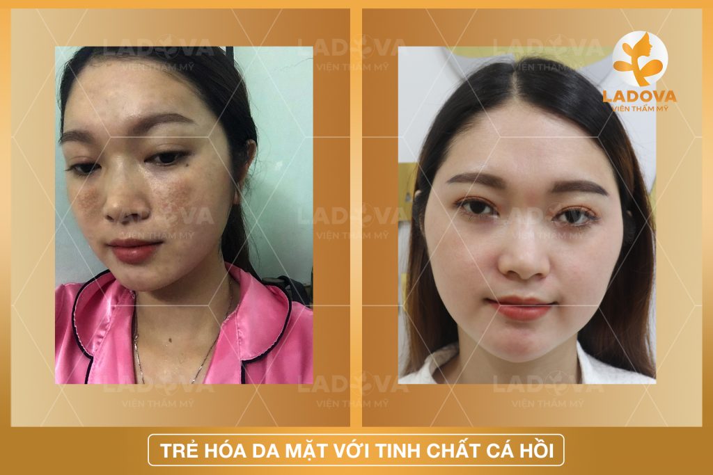 TRE-HOA-DA-MAT