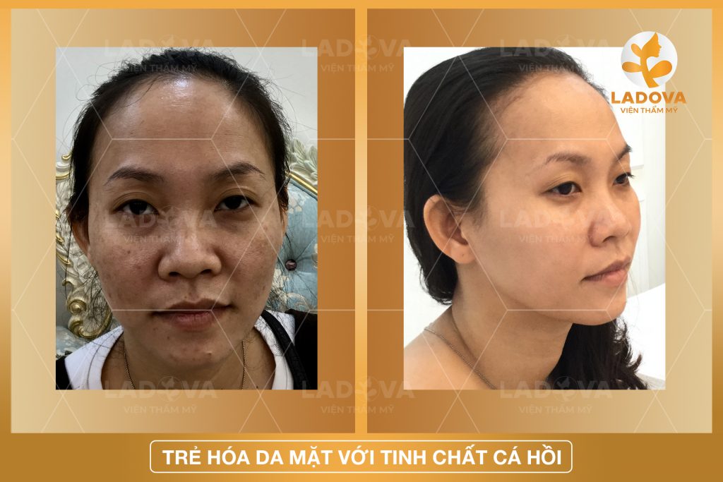 TRE-HOA-DA-MAT-HIEU-QUA