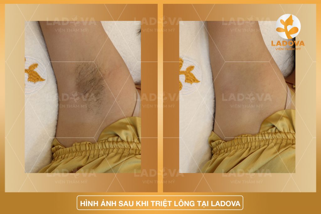 TRIET-LONG-NACH-TAN-GOC