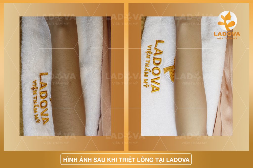 TRIET-LONG-TAY-VINH-VIEN