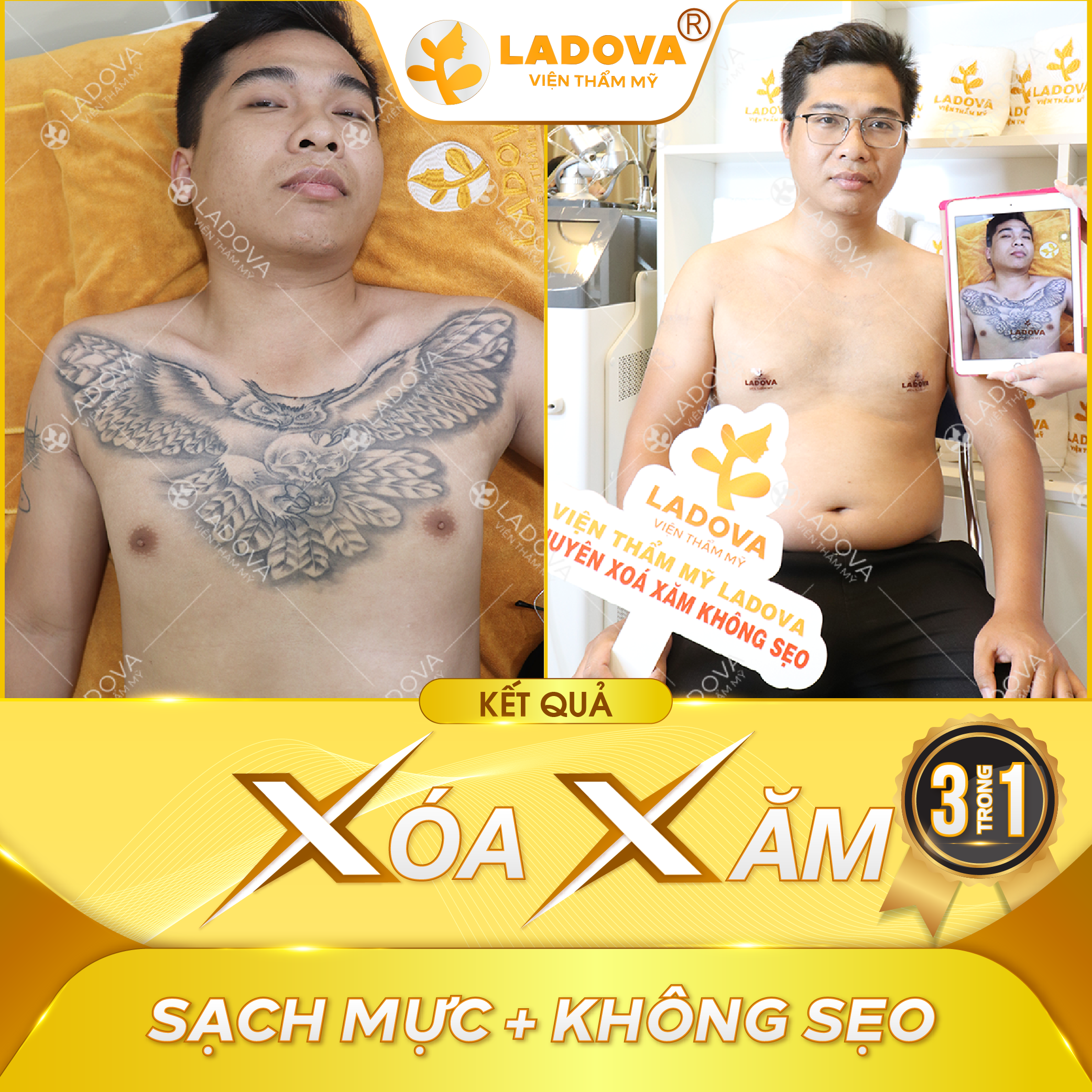 hinh-xanh-xoa-xam-01